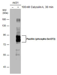 Anti-Paxillin (phospho Ser273) antibody used in Western Blot (WB). GTX132362
